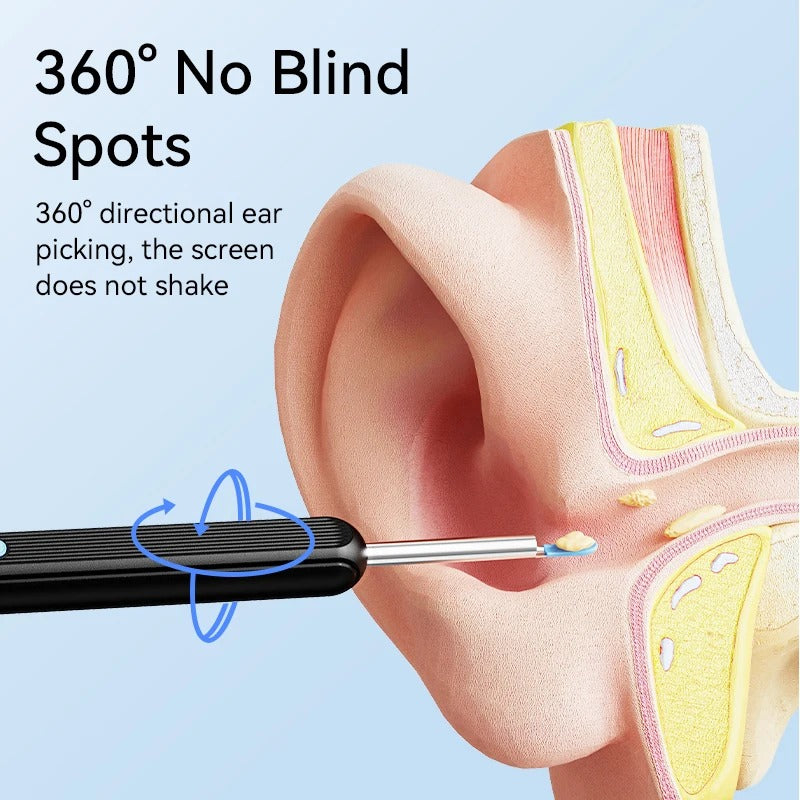 Smart Visual Ear Cleaner (5MP Endoscope)