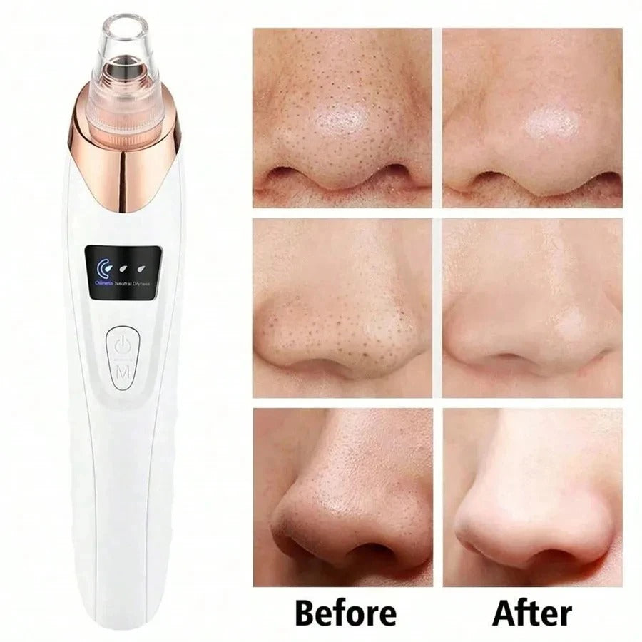 Electric Blackhead Remover (Pore Cleaning Device)
