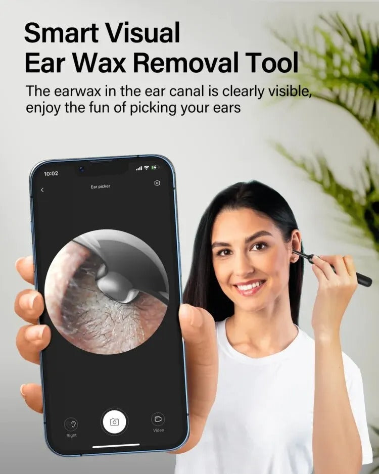 Smart Visual Ear Cleaner (1080P HD Visual Otoscope)